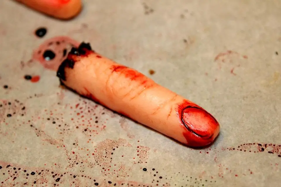 Severed Finger