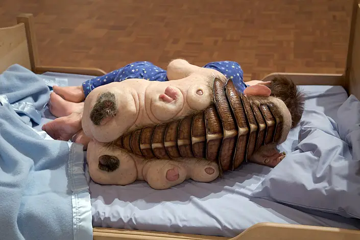 Partricia Paccinini's Undivided one of the most disturbing pieces of art