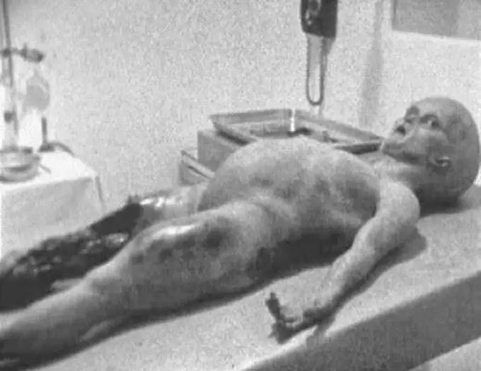 Still shot taken from the video footage of Alien Autopsy - 8 Greatest Hoaxes Of All Time