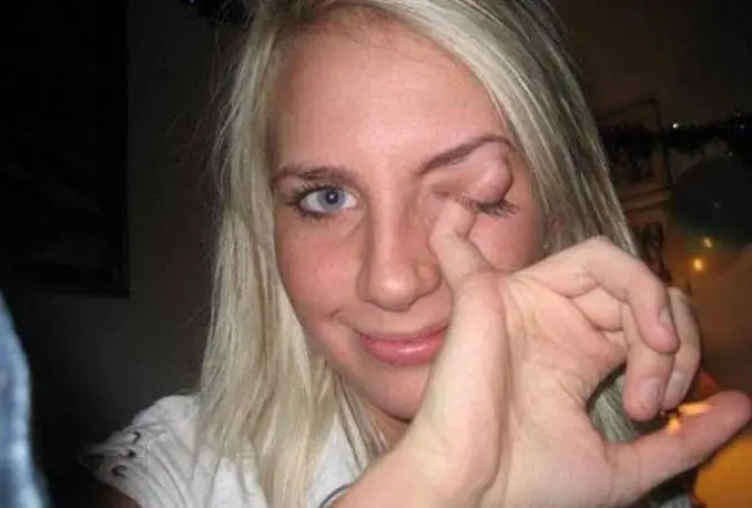 A girl sticking her finger in her eyelid - 20 WTF Photos You Just Have To See