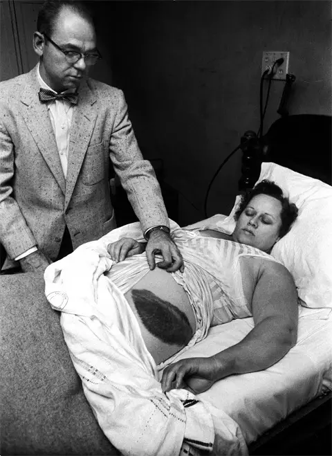 This real photo with a creepy backstory is of the first person to ever be injured by a meteorite. 