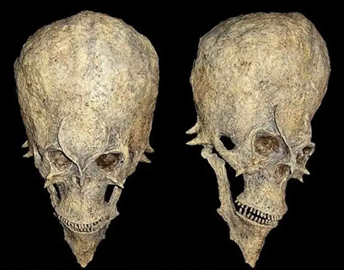 A mysterious photo of a skull discovered in Africa that is 14 million years old.