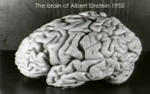 Einstein's brain would have to be one of t he strangest things ever stolen