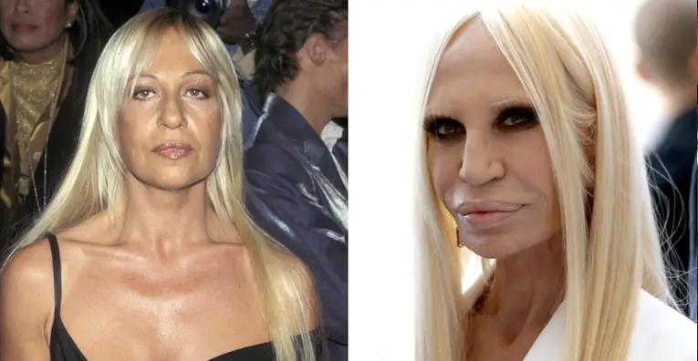 These are the craziest plastic surgeries.