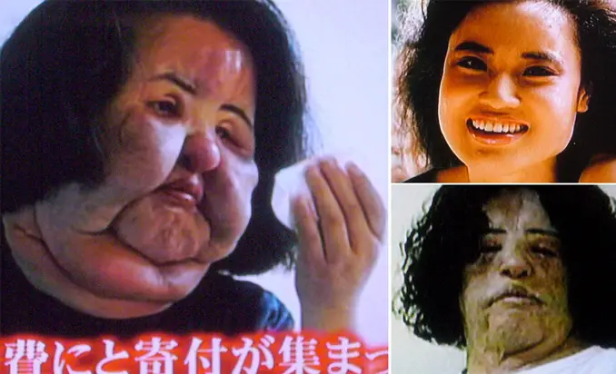 These are the craziest plastic surgeries ever performed.