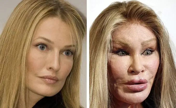 These are the craziest plastic surgeries