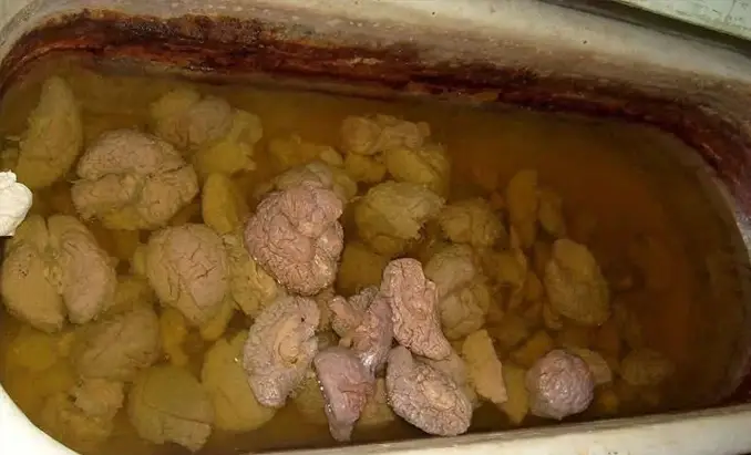 Bathtub Full of Brains in Abandoned Hospital - 10 Creepiest Things Discovered in Abandoned Buildings