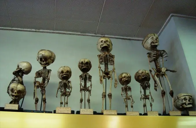 The Musee Depuytren is one of the Creepiest Museums in the World